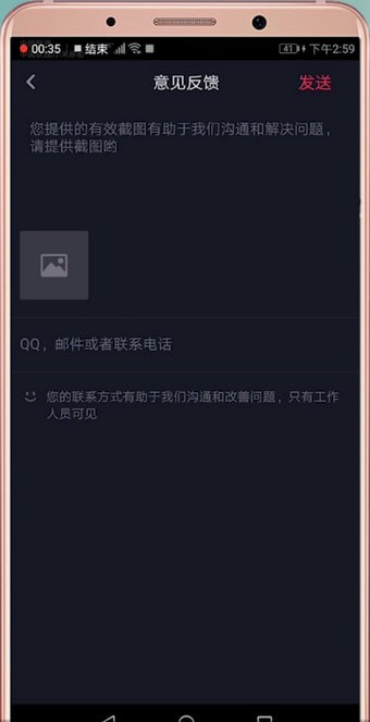 在抖音里怎么聯系客服？聯系客服的方法說明
