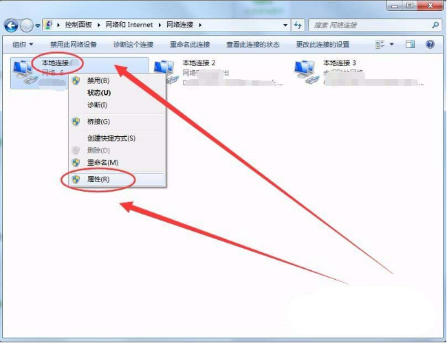 win7系統(tǒng)DNS Server設置不符怎么解決?